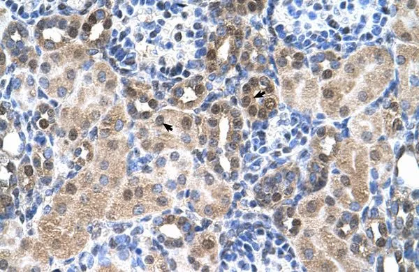IHC-P analysis of human kidney tissue using GTX46756 SLC46A3 antibody at 4.0-8.0microg/ml. IHC-P analysis of human kidney tissue using GTX46756 SLC46A3 antibody at 4.0-8.0microg/ml.