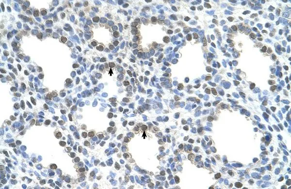 IHC-P analysis of human lung tissue using GTX46773 SLC15A4 antibody at 4.0-8.0microg/ml. IHC-P analysis of human lung tissue using GTX46773 SLC15A4 antibody at 4.0-8.0microg/ml.