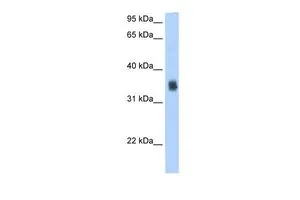WB analysis of 293T cells using GTX46812 SLC35F2 antibody at 2.5microg/ml.