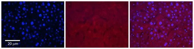 IHC-P analysis of human liver tissue using GTX46845 SLC37A4 antibody at 1:100. Left to right : DAPI, SLC37A4, Merge. The low pH, heat-induced antigen retrieval method utilizing Sodium Citrate buffer was performed. IHC-P analysis of human liver tissue using GTX46845 SLC37A4 antibody at 1:100. Left to right : DAPI, SLC37A4, Merge. The low pH, heat-induced antigen retrieval method utilizing Sodium Citrate buffer was performed.