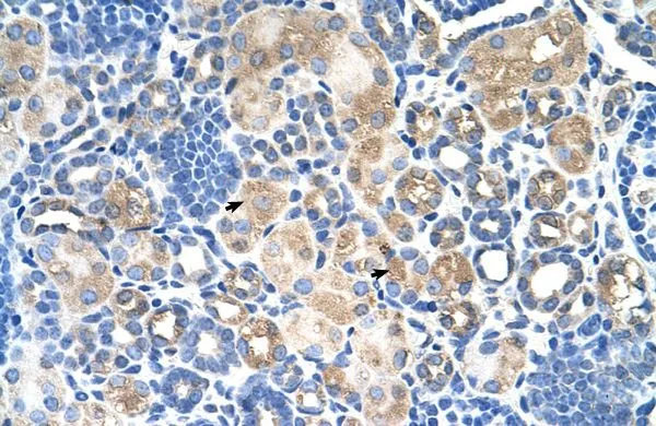 IHC-P analysis of human kidney tissue using GTX46848 SLC38A1 antibody at 4.0-8.0microg/ml. IHC-P analysis of human kidney tissue using GTX46848 SLC38A1 antibody at 4.0-8.0microg/ml.