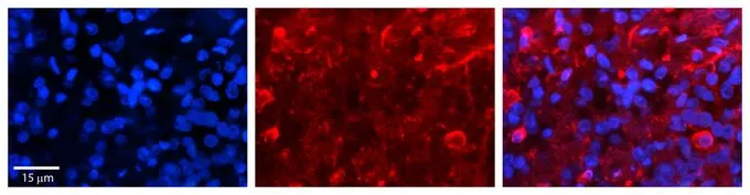 IHC-P analysis of human pineal tissue using GTX46853 SLC27A6 antibody at 1:100. Left to right:DAPI, SLC27A6, Merge. Low pH, heat-induced antigen retrieval method utilizing Sodium Citrate buffer. IHC-P analysis of human pineal tissue using GTX46853 SLC27A6 antibody at 1:100. Left to right:DAPI, SLC27A6, Merge. Low pH, heat-induced antigen retrieval method utilizing Sodium Citrate buffer.