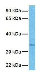 WB analysis of NCI-H226 cells using GTX46870 GLS2 antibody at 1microg/ml.
