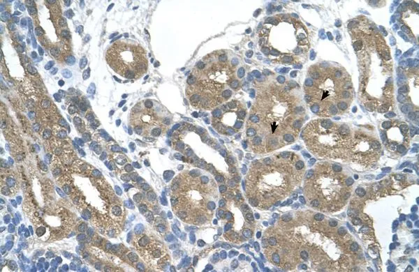 IHC-P analysis of human kidney tissue using GTX46889 RNF165 antibody at 4.0-8.0microg/ml. IHC-P analysis of human kidney tissue using GTX46889 RNF165 antibody at 4.0-8.0microg/ml.