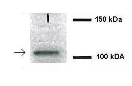 WB analysis of human cystic fibrosis epithelial cells using GTX46924 NEDD4L antibody at 1:3000.