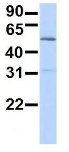 WB analysis of human placenta tissue using GTX46928 FBXO3 antibody at 1.0microg/ml.