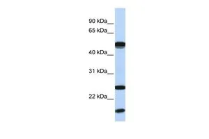 WB analysis of MCF-7 cells using GTX46937 UBE2L6 antibody at 0.2-1microg/ml. WB analysis of MCF-7 cells using GTX46937 UBE2L6 antibody at 0.2-1microg/ml.