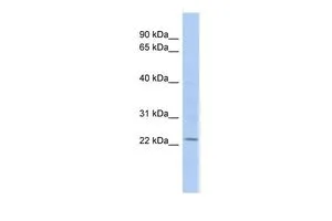 WB analysis of COLO205 cells using GTX46938 UBE2E1 antibody at 0.2-1microg/ml. WB analysis of COLO205 cells using GTX46938 UBE2E1 antibody at 0.2-1microg/ml.