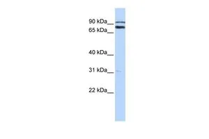WB analysis of HepG2 cells using GTX46943 TRIM67 antibody at 0.2-1microg/ml. WB analysis of HepG2 cells using GTX46943 TRIM67 antibody at 0.2-1microg/ml.