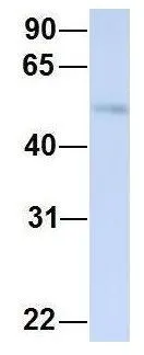 WB analysis of human placenta tissue using GTX46946 TJAP1 antibody at 1microg/ml. WB analysis of human placenta tissue using GTX46946 TJAP1 antibody at 1microg/ml.