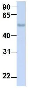 WB analysis of human fetal lung tissue using GTX46946 TJAP1 antibody at 1microg/ml.