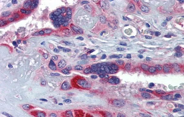 IHC-P analysis of human placenta tissue using GTX46947 GTPBP10 antibody at 5.0microg/ml. IHC-P analysis of human placenta tissue using GTX46947 GTPBP10 antibody at 5.0microg/ml.
