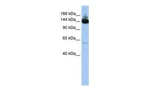 WB analysis of HepG2 cells using GTX46951 SYMPK antibody at 0.2-1microg/ml. WB analysis of HepG2 cells using GTX46951 SYMPK antibody at 0.2-1microg/ml.