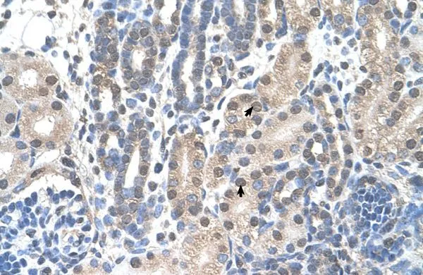 IHC-P analysis of human kidney tissue using GTX46959 FAM174B antibody at 4.0-8.0microg/ml. IHC-P analysis of human kidney tissue using GTX46959 FAM174B antibody at 4.0-8.0microg/ml.