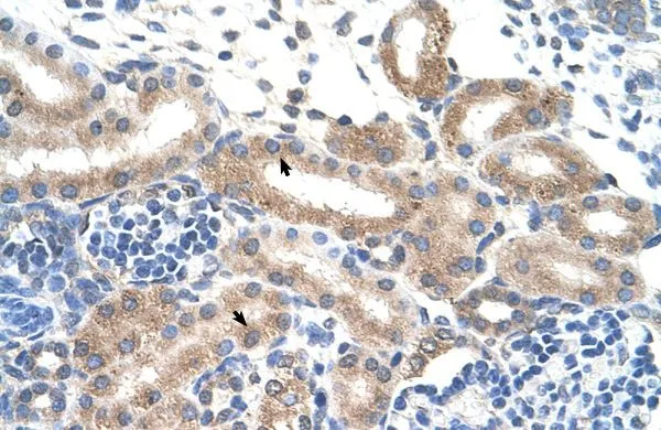 IHC-P analysis of human kidney tissue using GTX46960 FAM174B antibody at 4.0-8.0microg/ml. IHC-P analysis of human kidney tissue using GTX46960 FAM174B antibody at 4.0-8.0microg/ml.