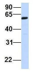 WB analysis of human placenta tissue using GTX46963 ZGPAT antibody at 1microg/ml.