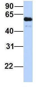 WB analysis of human fetal heart tissue using GTX46963 ZGPAT antibody at 1microg/ml.