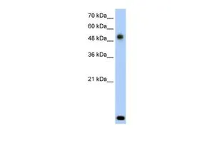 WB analysis of Jurkat cells using GTX46970 RSAD2 antibody at 2.5microg/ml. WB analysis of Jurkat cells using GTX46970 RSAD2 antibody at 2.5microg/ml.