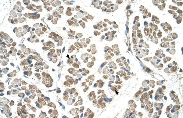 IHC-P analysis of human muscle tissue using GTX46979 EGFL8 antibody at 4-8microg/ml. IHC-P analysis of human muscle tissue using GTX46979 EGFL8 antibody at 4-8microg/ml.