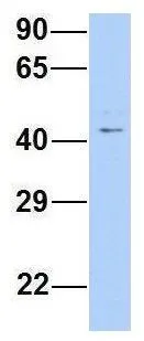 WB analysis of human B lymphoblast cells using GTX46982 TRABD antibody at 1microg/ml.