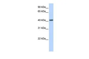 WB analysis of human fetal muscle tissue using GTX46991 LRRC2 antibody at 0.2-1microg/ml. WB analysis of human fetal muscle tissue using GTX46991 LRRC2 antibody at 0.2-1microg/ml.