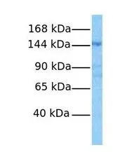 WB analysis of OVCAR-3 cells using GTX47001 KIAA1199 antibody at 1microg/ml.