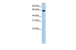 WB analysis of HeLa cells using GTX47008 EPS8L1 antibody at 0.2-1microg/ml. WB analysis of HeLa cells using GTX47008 EPS8L1 antibody at 0.2-1microg/ml.