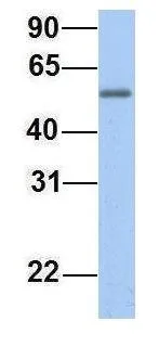 WB analysis of human placenta tissue using GTX47008 EPS8L1 antibody at 1microg/ml.