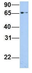WB analysis of 293T cells using GTX47008 EPS8L1 antibody at 1microg/ml.