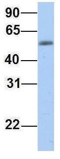 WB analysis of human fetal muscle tissue using GTX47008 EPS8L1 antibody at 1microg/ml.