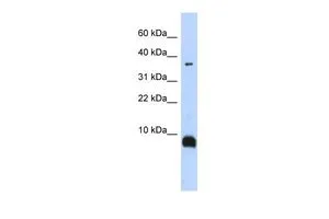 WB analysis of human fetal brain tissue using GTX47036 TAC3 antibody at 0.2-1microg/ml. WB analysis of human fetal brain tissue using GTX47036 TAC3 antibody at 0.2-1microg/ml.