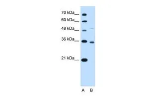 WB analysis of HepG2 cells using GTX47047 SLC38A3 antibody at 0.2-1ug/ml. Lane A : marker Lane B : HepG2 cells