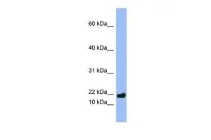 WB analysis of NCI-H226 cells using GTX47060 SPRR3 antibody at 0.2-1microg/ml. WB analysis of NCI-H226 cells using GTX47060 SPRR3 antibody at 0.2-1microg/ml.