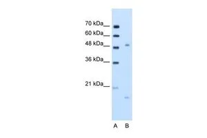 WB analysis of Jurkat cells using GTX47065 ITGBL1 antibody at 2.5microg/ml. Lane A : marker Lane B : Jurkat cells WB analysis of Jurkat cells using GTX47065 ITGBL1 antibody at 2.5microg/ml. Lane A : marker Lane B : Jurkat cells