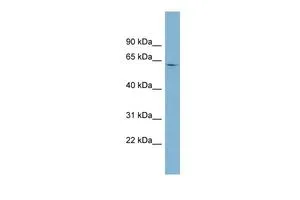 WB analysis of human fetal thymus tissue using GTX47066 EPB41 antibody at 0.2-1microg/ml. WB analysis of human fetal thymus tissue using GTX47066 EPB41 antibody at 0.2-1microg/ml.