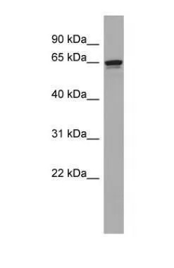 WB analysis of ACHN cells using GTX47067 DMPK antibody at 1microg/ml. WB analysis of ACHN cells using GTX47067 DMPK antibody at 1microg/ml.