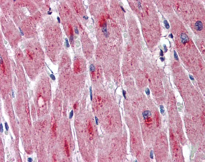 IHC-P analysis of human heart tissue using GTX47067 DMPK antibody at 5microg/ml.