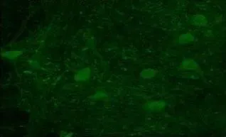 IHC-P analysis of Rhesus macaque spinal cord tissue using GTX47068 ATP2A1 antibody at 1:300. IHC-P analysis of Rhesus macaque spinal cord tissue using GTX47068 ATP2A1 antibody at 1:300.