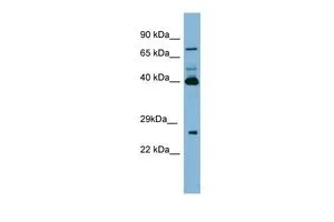 WB analysis of PANC1 cells using GTX47078 TGM3 antibody at 0.2-1microg/ml.