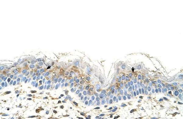IHC-P analysis of human skin tissue using GTX47086 S100A3 antibody at 4.0-8.0microg/ml. IHC-P analysis of human skin tissue using GTX47086 S100A3 antibody at 4.0-8.0microg/ml.