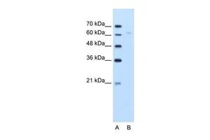 WB analysis of Jurkat cells using GTX47093 DLAT antibody at 5.0microg/ml. Lane A : marker Lane B : Jurkat cells