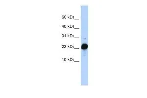 WB analysis of human placenta tissue using GTX47094 CSHL1 antibody at 0.2-1microg/ml. WB analysis of human placenta tissue using GTX47094 CSHL1 antibody at 0.2-1microg/ml.