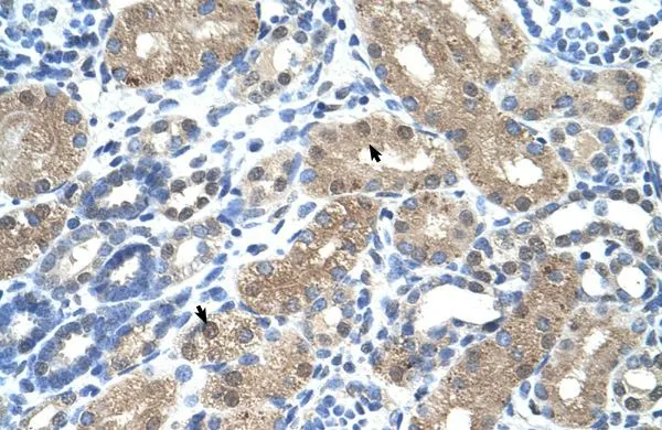 IHC-P analysis of human kidney tissue using GTX47099 C9ORF127 antibody at 4.0-8.0microg/ml. IHC-P analysis of human kidney tissue using GTX47099 C9ORF127 antibody at 4.0-8.0microg/ml.