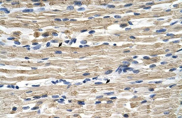 IHC-P analysis of human skeletal muscle tissue using GTX47111 GSTM2 antibody at 4.0-8.0microg/ml. IHC-P analysis of human skeletal muscle tissue using GTX47111 GSTM2 antibody at 4.0-8.0microg/ml.
