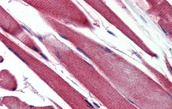 IHC-P analysis of human skeletal muscle tissue using GTX47111 GSTM2 antibody at 5microg/ml.