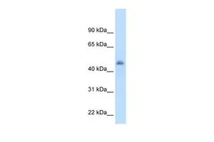 WB analysis of human liver tissue using GTX47116 Cytochrome P450 3A7 antibody at 2.5microg/ml. WB analysis of human liver tissue using GTX47116 Cytochrome P450 3A7 antibody at 2.5microg/ml.