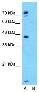 WB analysis of MCF-7 cells using GTX47120 EPX antibody at 1microg/ml.