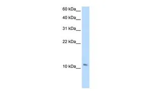 WB analysis of human fetal muscle tissue using GTX47137 SMPX antibody at 2.5microg/ml. WB analysis of human fetal muscle tissue using GTX47137 SMPX antibody at 2.5microg/ml.