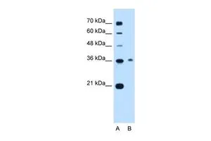 WB analysis of Jurkat cells using GTX47138 C11ORF54 antibody at 0.2-1microg/ml. Lane A : marker Lane B : Jurkat cells WB analysis of Jurkat cells using GTX47138 C11ORF54 antibody at 0.2-1microg/ml. Lane A : marker Lane B : Jurkat cells
