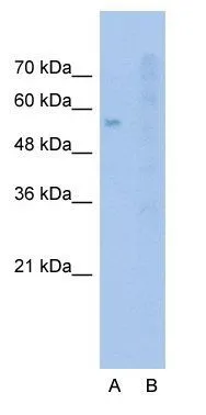 WB analysis of Jurkat cells using GTX47150 SLC22A1 antibody at 2.5ug/ml. Lane A : Primary antibody Lane B : Primary antibody + Blocking peptide